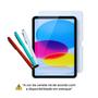 Imagem de Kit Essencial: Capa Smart Case P/ Tablet Hd10 + Pelicula + Caneta Touch
