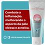 Imagem de Kit Linha Ozônio Kokeshi Creme Gel Facial