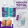 Imagem de Kit Mahav Pro Cal + Bisturi 222 + 10 Botinhas + Algodão 50G