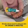 Imagem de Kit Removedor de Calos Dr. Scholl's Fast Action - Com Arquivo