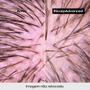 Imagem de L'Oréal Professionnel Scalp Tratamento Calmante