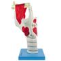 Imagem de Laringe Funcional Ampliada 3x, Anatomia