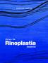 Imagem de Livro - Atlas de Rinoplastia