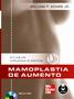 Imagem de Livro - Mamoplastia de Aumento