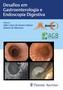 Imagem de Livro - SOBED Desafios em Gastroenterologia e Endoscopia Digestiva