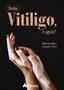 Imagem de Livro - Tenho vitiligo, e agora?