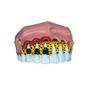 Imagem de Macro Modelo Evolução da Doença Periodontal