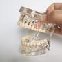 Imagem de Manequim Molde Modelo Dentário Ortodontia Dente Implante