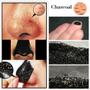 Imagem de Máscara Facial SHILLS Blackhead Remover - Controle de Poros 50mL