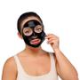 Imagem de Máscara Limpeza Facial Remove Cravo Espinha 82 ml