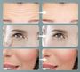 Imagem de Massageador Facial Alta Tecnologia Anti rugas - FACE MASSAGER