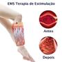 Imagem de Massageador Portátil Recarregável Compressão Prevenção Doenças Vasculares