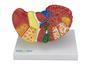Imagem de Modelo anatômico patológico do fígado e vesícula biliar sd5206