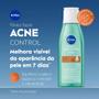 Imagem de NIVEA Tônico Facial Acne Control