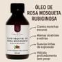 Imagem de Óleo Vegetal de Rosa Mosqueta Rubigionosa Puro Clareador de Manchas Melasma Virilha Axilas Estrias Cicatrizante
