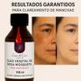 Imagem de Óleo Vegetal de Rosa Mosqueta Rubigionosa Puro Clareador de Manchas Melasma Virilha Axilas Estrias Cicatrizante