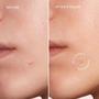 Imagem de Pimple Patches MAREE Star - Tratamento Facial com Algas Verdes e Óleo de Melaleuca