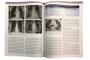 Imagem de Pneumologia - Atualização e Reciclagem - Elsevier