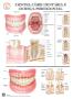 Imagem de Pôster Dentes, Cárie Dentária e Doença Periodontal