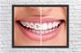 Imagem de Quadro Decorativo Dentista Odontologia Dentes Sorriso Consultórios Salas Decorações Com Moldura