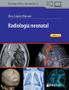Imagem de Radiologia neonatal (espanhol) - EDICIONES JOURNAL SA