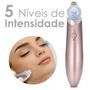 Imagem de Removedor Cravos Espinhas Acne Extrator Facial A Vácuo