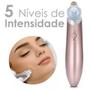 Imagem de Removedor Cravos Extrator Facial A Vácuo Sucção Xn-8030