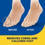 Imagem de Removedor de Calos e Milho Dr. Scholl's - 10ml com Almofadas