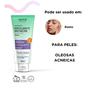 Imagem de Sabonete Esfoliante Antiacne 80ml - LABOTRAT