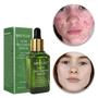 Imagem de Sérum Breylee Tratamento Facial Acne Cravo Limpeza Pele 17Ml