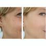 Imagem de Sérum Facial Clareador Manchas Escuras Niacinamida 25% Ácido Hialurônico Skincare Rosa Selvagem 30ml Vegano