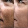 Imagem de Serum Facial Klassis Tx Theraskin 30g Clareia a Pele com Resultado 1 Semana