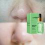 Imagem de Sérum Facial LANBENA Pore Minimizer 18ml com Centella Asiatica