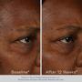 Imagem de Sérum Facial Obagi ElastiDerm Firming - Com Bi-Mineral - 30ml