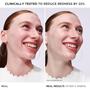 Imagem de Sérum IT Cosmetics Bye Bye Redness - Calmante para a Pele (30ml)