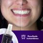 Imagem de Sérum Matizador Dental - 30mL Dentes mais brancos
