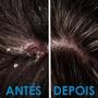 Imagem de Shampoo Anticaspa 500ml Hidrabell