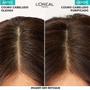 Imagem de Shampoo Elseve Pure Hialuronico 400ml