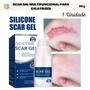 Imagem de Silicone Scar Gel Removedor De Cicatrizes Fórmula Avançada (30 g)