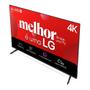 Smart Tv LG 65" 4K Ultra HD WebOS 25 AI Magic Alexa 65UA7500 Imagem de Smart Tv LG 65" 4K Ultra HD WebOS 25 AI Magic Alexa 65UA7500