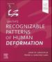 Imagem de Smith recognizable patterns of human deformation