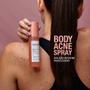 Imagem de Solução Antiacne Para o Corpo - Body Acne Spray 100ml