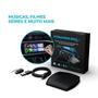 Imagem de Streaming Box Soft Automotivo Para Carros C/ Sistema Carplay WiFi E Bluetooth Integrados