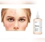 Imagem de The Ordinary Tônico De Ácido Glicólico 7% 100ml