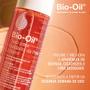 Imagem de Tratamento Antiestrias Bio-Oil