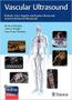 Imagem de Vascular ultrasound - Thieme Publishers Inc 2024