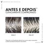 Imagem de Vichy Dercos Shampoo Anticaspa DS - Cabelos Secos